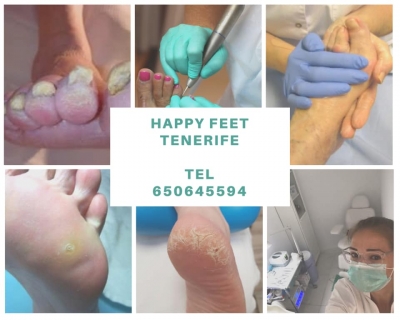 Happy Feet Tenerife Medical Pedicure